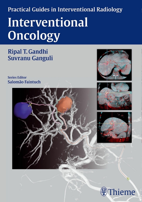 Interventional Oncology - 