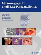 Microsurgery of Skull Base Paragangliomas -  Paolo Piazza,  Seung-Ho Shin,  Sean Flanagan,  Mario Sanna,  Fernando Mancini