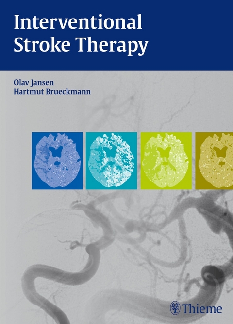 Interventional Stroke Therapy -  Olav Jansen,  Hartmut Brückmann