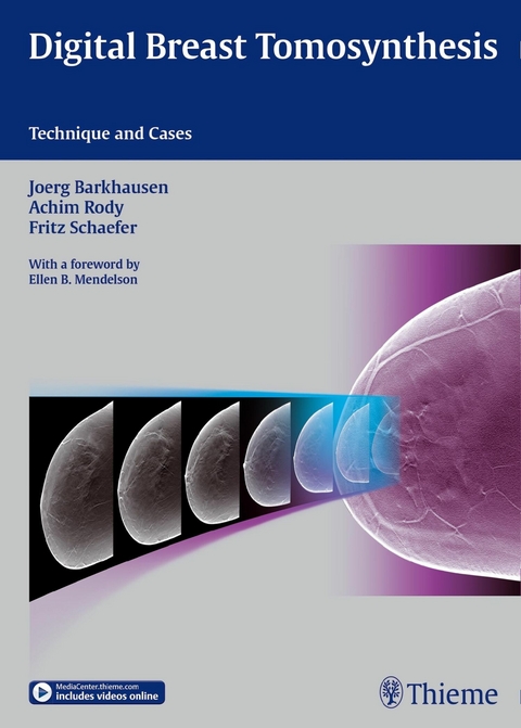 Digital Breast Tomosynthesis -  Joerg Barkhausen,  Achim Rody,  Fritz K.W. Schäfer