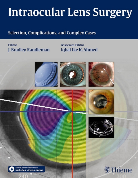 Intraocular Lens Surgery -  Bradley Randleman,  Iqbal Ike K Ahmed