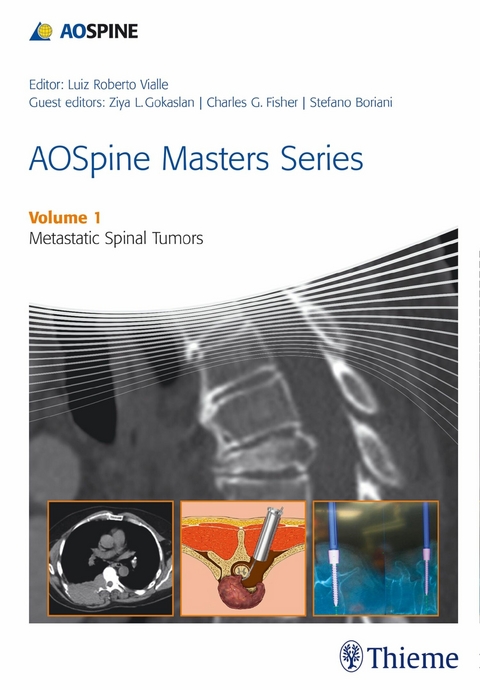 AOSpine Masters Series, Volume 1: Metastatic Spinal Tumors - 