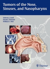 Tumors of the Nose, Sinuses and Nasopharynx -  Valerie J. Lund,  David Howard,  William I. Wei