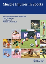 Muscle Injuries in Sports - 