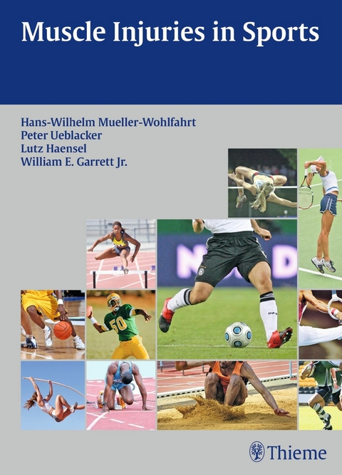 Muscle Injuries in Sports - 