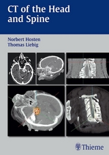 CT of the Head and Spine - Norbert Hosten, Thomas Liebig