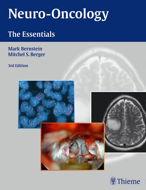 Neuro-Oncology: The Essentials - 