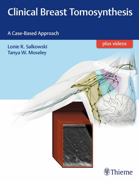 Clinical Breast Tomosynthesis -  Lonie R. Salkowski,  Tanya Moseley