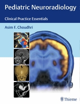 Pediatric Neuroradiology -  Asim F. Choudhri