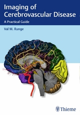 Imaging of Cerebrovascular Disease -  Val M. Runge