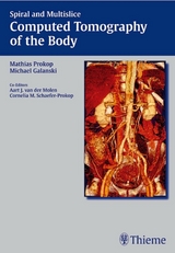 Spiral and Multislice Computed Tomography of the Body - 