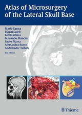 Atlas of Microsurgery of the Lateral Skull Base -  Mario Sanna,  Tarek Khrais,  Fernando Mancini,  Essam A. Saleh,  Paolo Piazza,  Alessandra Russo,  Abdelka