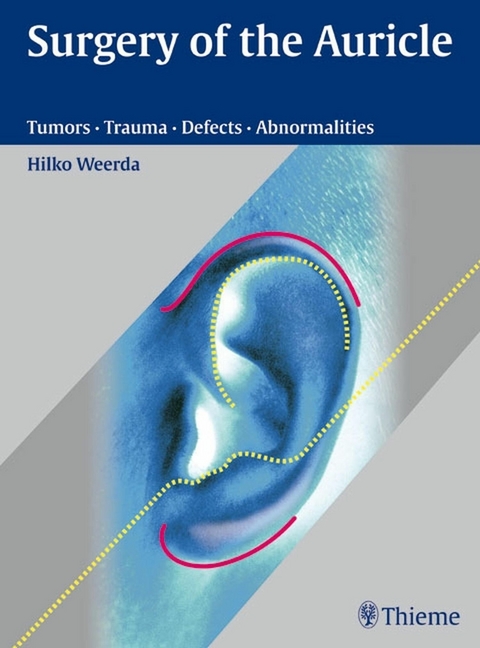 Surgery of the Auricle -  Hilko Weerda