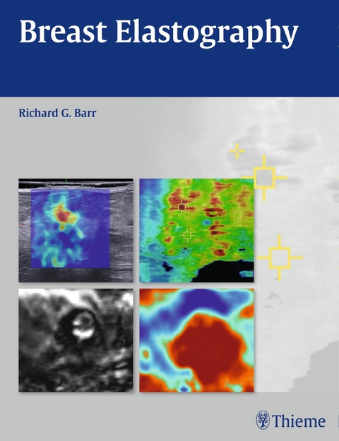 Breast Elastography -  Richard G. Barr