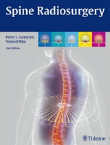 Spine Radiosurgery - 