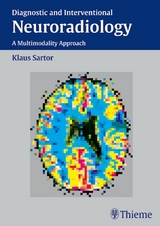 Diagnostic and Interventional Neuroradiology - Klaus Sartor