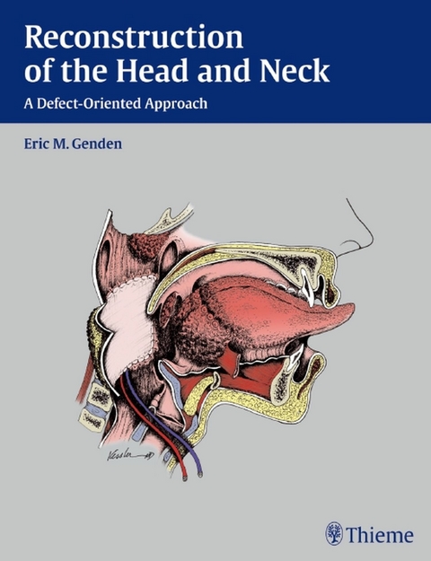 Reconstruction of the Head and Neck -  Eric M. Genden