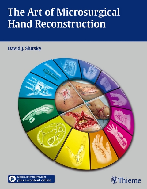 The Art of Microsurgical Hand Reconstruction - 