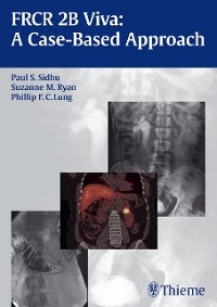 FRCR 2B Viva: A Case-Based Approach -  Paul S. Sidhu,  Suzanne Ryan,  Phillip F.C. Lung