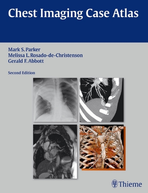 Chest Imaging Case Atlas -  Mark S. Parker,  Melissa L. Rosado-de-Christenson,  Gerald F. Abbott