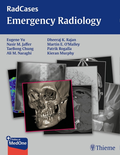 Radcases Emergency Radiology -  Eugene Yu,  Nasir Jaffer,  TaeBong Chung,  Ali M. Naraghi,  Dheeraj Rajan,  Kieran Murphy,  Martin O'Malle