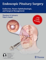 Endoscopic Pituitary Surgery - 