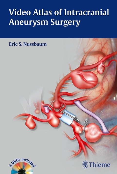 Video Atlas of Intracranial Aneurysm Surgery - 