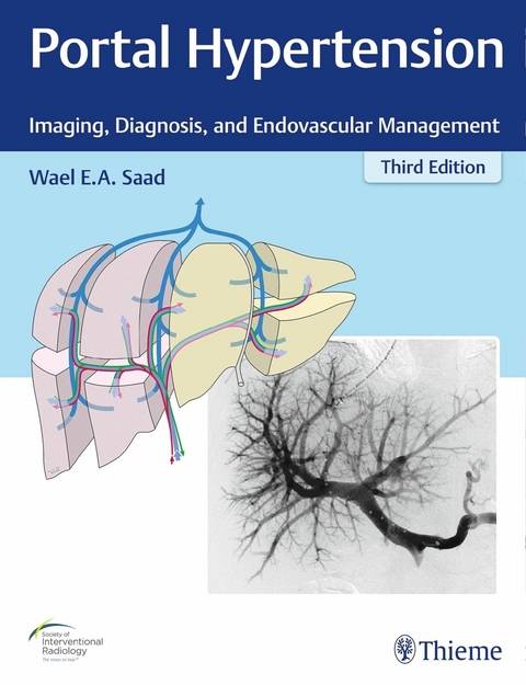 Portal Hypertension -  Wael E.A. Saad