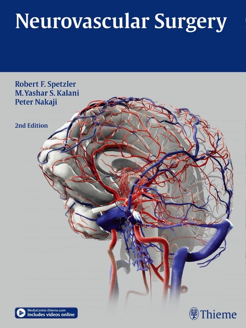 Neurovascular Surgery - 