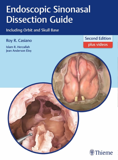 Endoscopic Sinonasal Dissection Guide -  Roy R. Casiano,  Islam Herzallah,  Jean Eloy