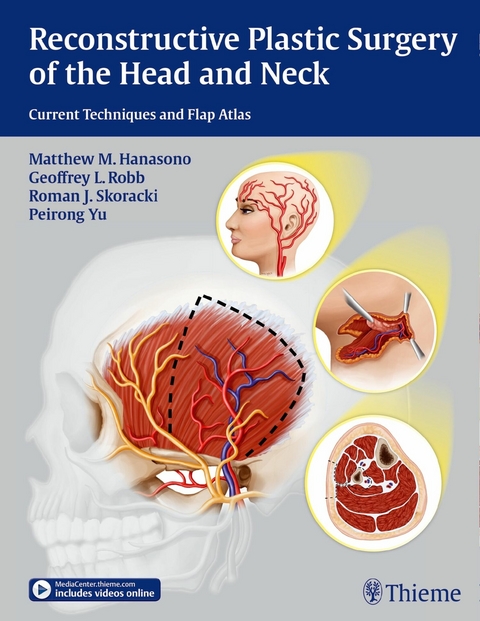 Reconstructive Plastic Surgery of the Head and Neck -  Matthew M. Hanasono,  Geoffrey L. Robb,  Roman J. Skoracki,  Peirong Yu