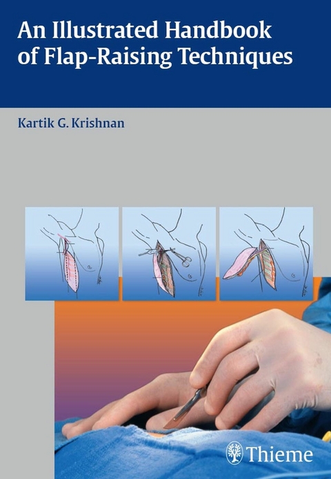 An Illustrated Handbook of Flap-Raising Techniques - Kartik G. Krishnan