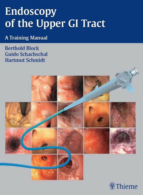 Endoscopy of the Upper GI Tract -  Berthold Block,  Guido Schachschal,  Hartmut H.-J. Schmidt