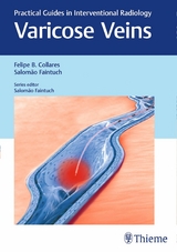 Varicose Veins -  Felipe Collares,  Salomao Faintuch