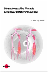 Die endovaskuläre Therapie peripherer Gefäßerkrankungen - Jörg Teßarek