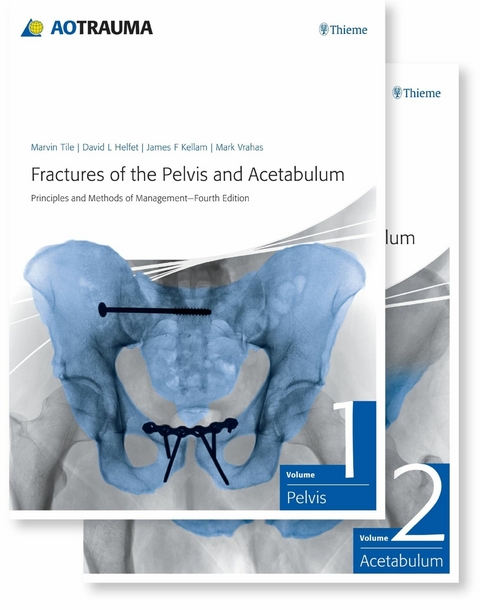 Fractures of the Pelvis and Acetabulum -  Marvin Tile,  David L. Helfet,  James F. Kellam,  Mark S. Vrahas