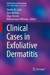 Clinical Cases in Exfoliative Dermatitis - 