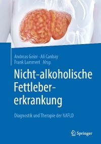 Nicht-alkoholische Fettlebererkrankung - 