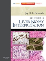 Scheuer's Liver Biopsy Interpretation - Lefkowitch, Jay H.