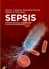 Sepsis - 