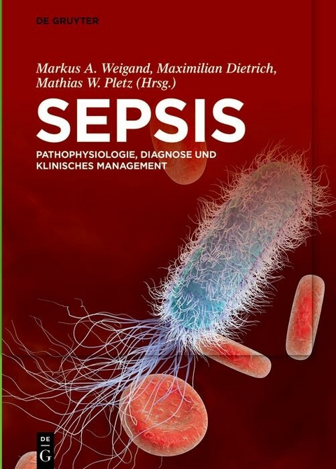 Sepsis - 