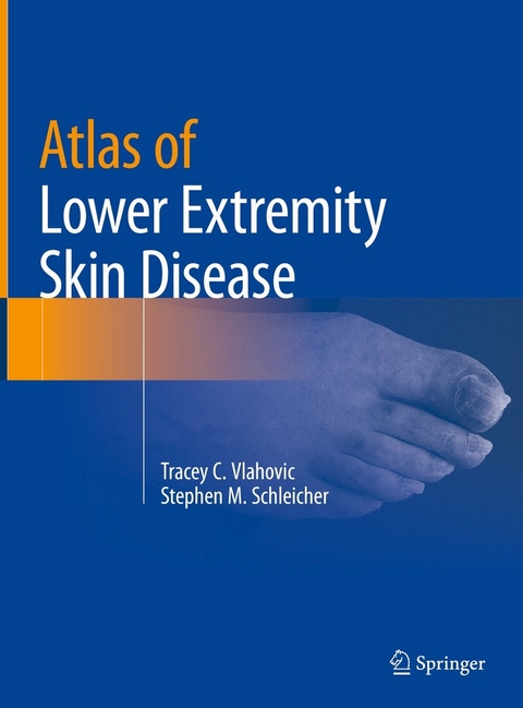 Atlas of Lower Extremity Skin Disease - Tracey C. Vlahovic, Stephen M. Schleicher