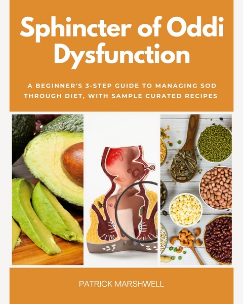 Sphincter of Oddi Dysfunction -  Patrick Marshwell