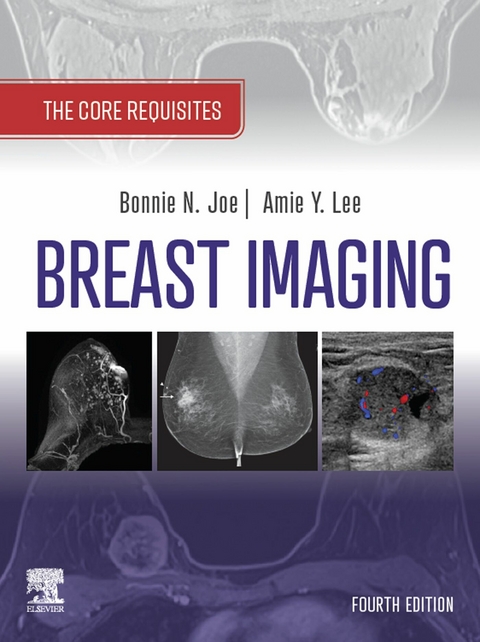 Breast Imaging, E-Book -  Bonnie N. Joe,  Amie Y. Lee