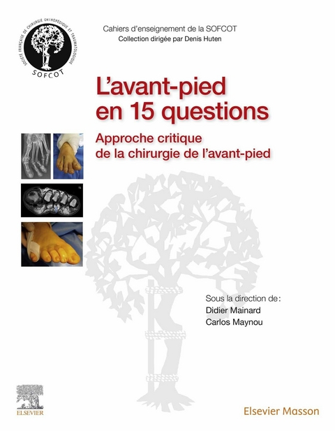 L''avant-pied en 15 questions -  Didier Mainard,  Carlos Maynou,  Sofcot