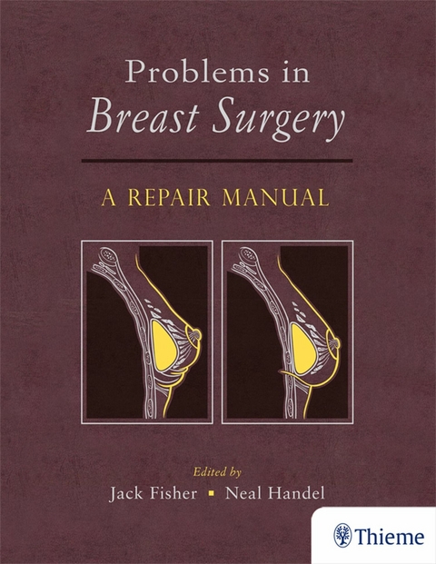 Problems in Breast Surgery - 