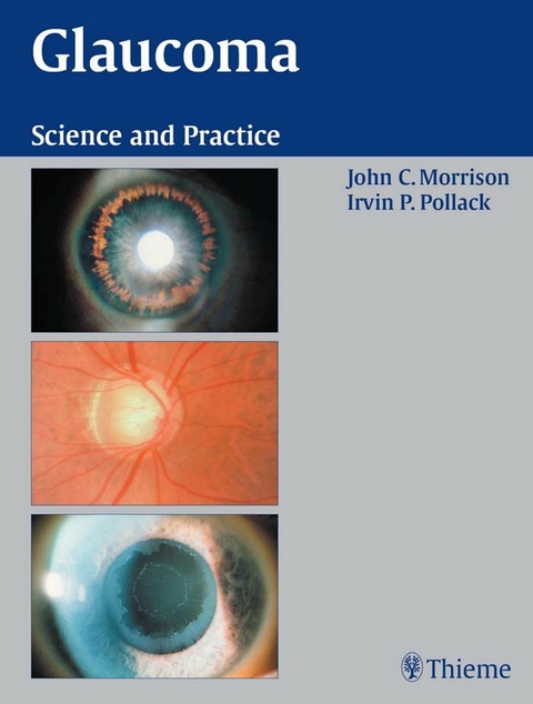 Glaucoma - John C. Morrison, Irvin P. Pollack