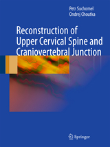 Reconstruction of Upper Cervical Spine and Craniovertebral Junction - Petr Suchomel, Ondrej Choutka