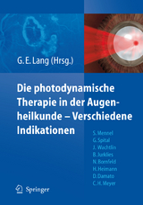 Die photodynamische Therapie in der Augenheilkunde - Verschiedene Indikationen - 