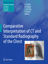 Comparative Interpretation of CT and Standard Radiography of the Chest - 